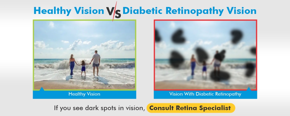 Diabetes and Vision Loss Tips: Healthy Eating - ConnectCenter