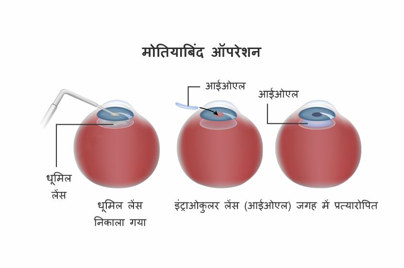 Obligation Meaning in Hindi: जानिए Obligation का हिंदी