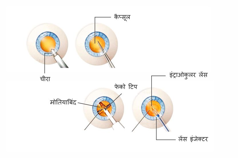 LOL Meaning In Hindi - लोल का मतलब क्या होता है? - Tech Yatri