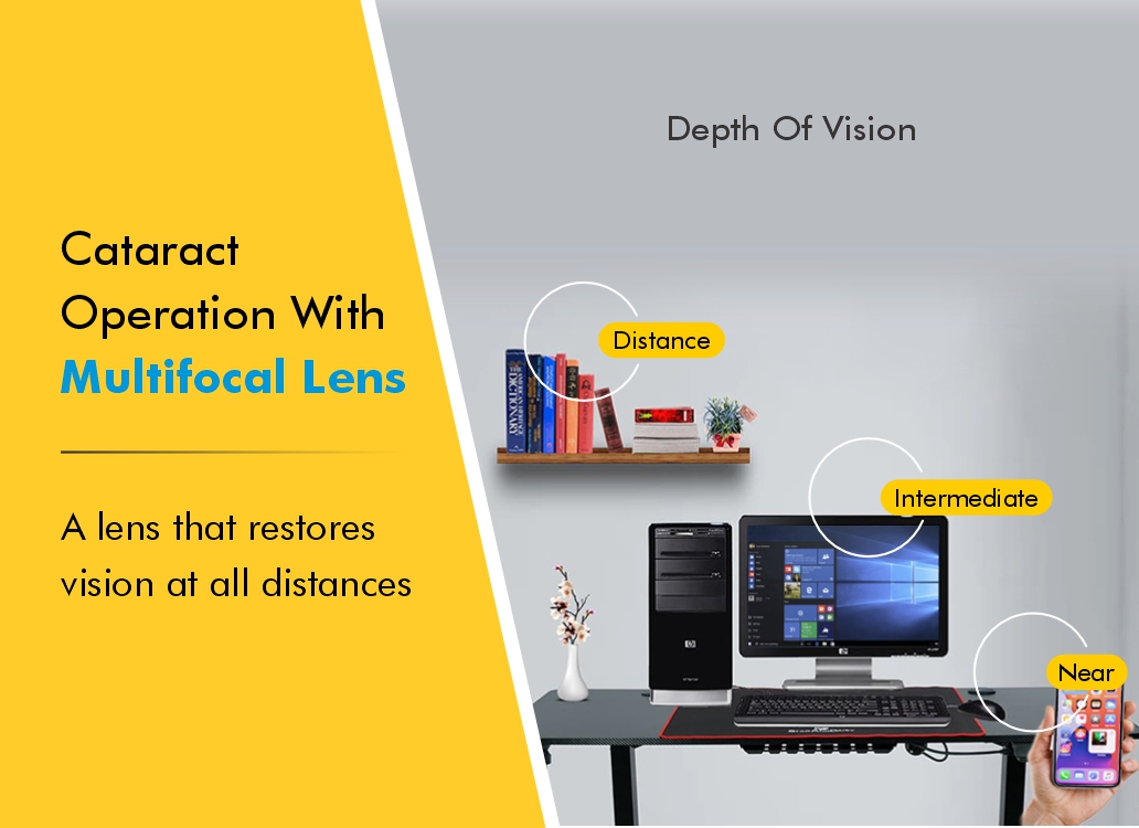 Multifocal Lenses for Cataract Operation Types & Prices